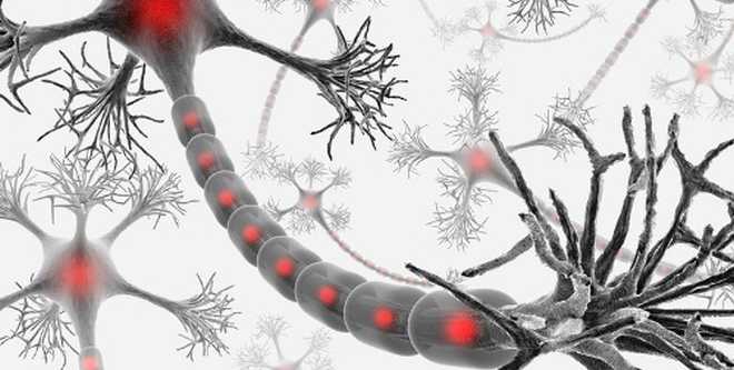 Bei der MS liegt eine Entzündung gegen dem Myelin der Nervenzellen vor.