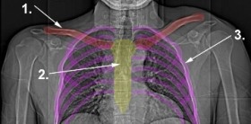 Abbildung Brustkorb (Thorax)