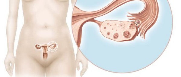 Anatomie der Eierstöcke