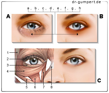 Ursachen Der Augenringe