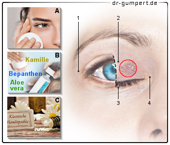 Trockene Augenlider Ursache Symptome Therapie