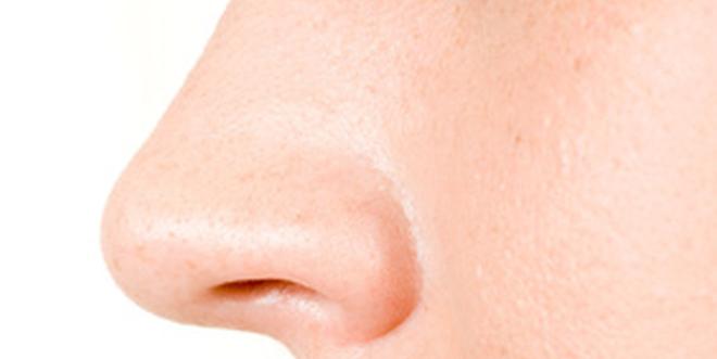 26+ schön Bilder Nasenfurunkel Innen - Entzündete Nase - Gründe & Hilfe bei wunder Nase | kanyo® - Der nasenfurunkel ist eine schmerzhafte, bis zu einigen zentimetern große, harte und gerötete schwellung mit zentralem eiterpfropf.